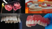 Featured image of SLA Found Stronger Than DLP, LCD for 3D Printing Dentures