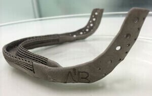 The custom-made, 3D-printed Titanium jaw (source: RHCC)
