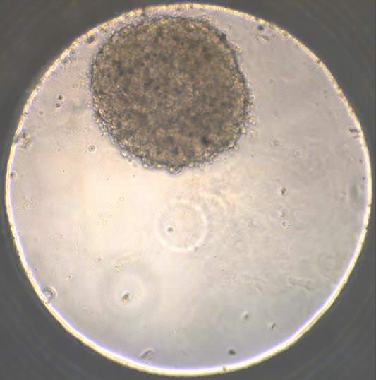 Another view of the heart organoid (image: Wake Forest Baptist Medical Center)