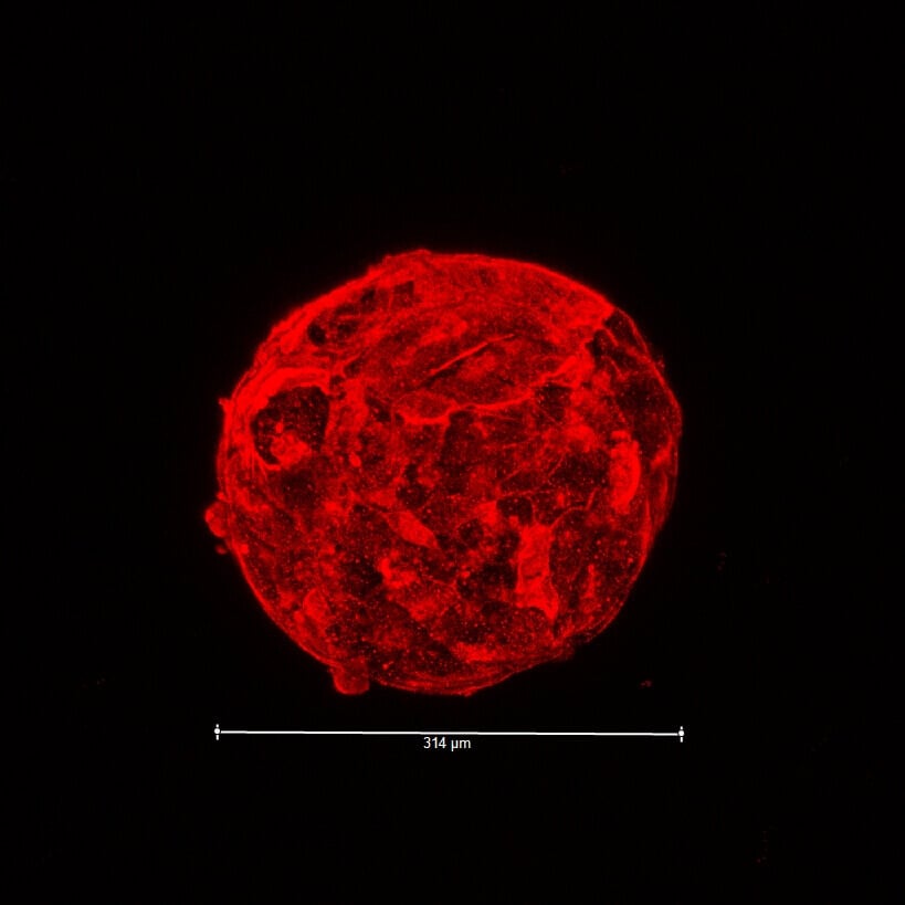 The liver organoid for the Body on a Chip project (image: Wake Forest Baptist Medical Center)