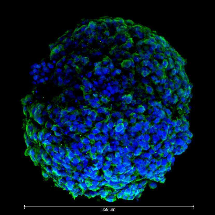 The heart organoid (image Wake Forest Baptist Medical Center)