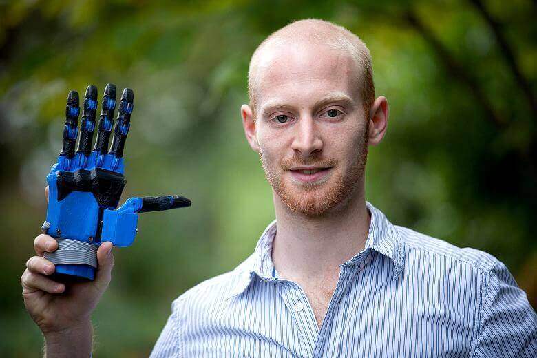 There are an estimated 11.4 million hand amputees worldwide: Joel Gibbard wants to help them (source: Open Hand)