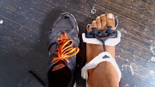 The Exo-Foot looks like a crossbreed of a sandal and some high-tech robotic exoskeleton (source: Onxy Ashanti)