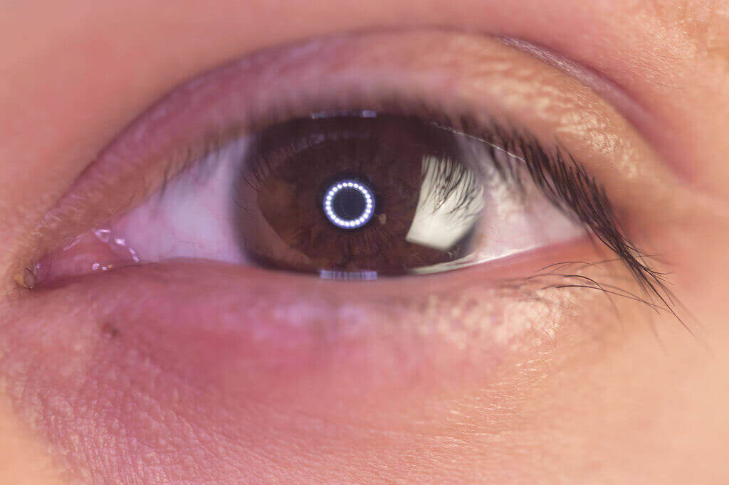 Ring lights are beautiful and they make beautiful, too.