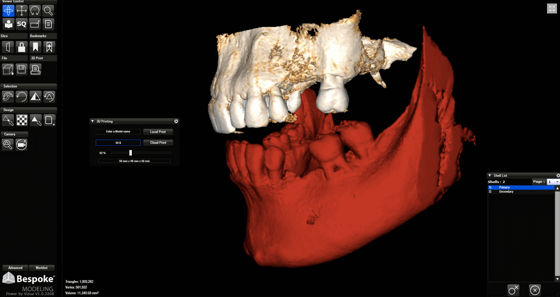 Vizua is an online, cloud-based 3D printing service that supports conversions from DICOM data (img: Vizua)