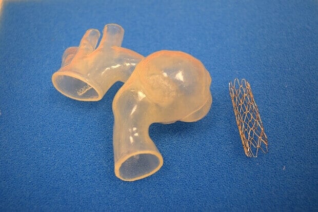 Aorta