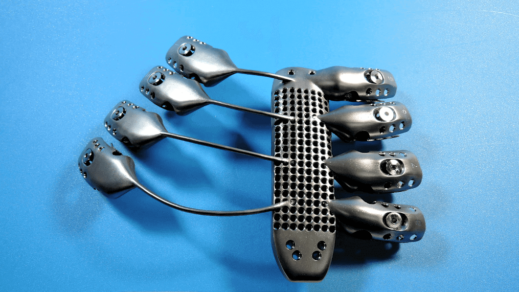 3d printed sternum