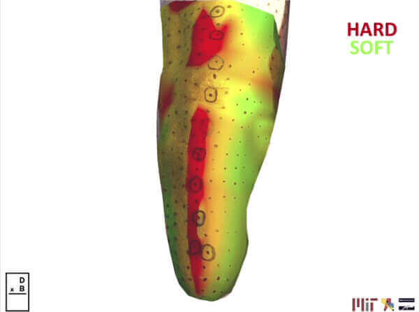 MIT’s invention FitSocket detects sense the soft-tissue properties in human limbs - this is needed for better protheses (image: MIT)