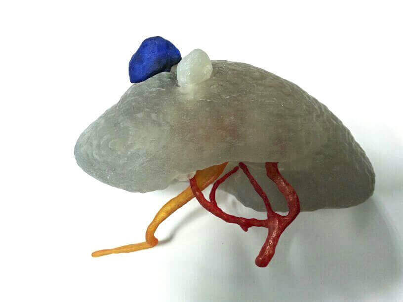 medical model