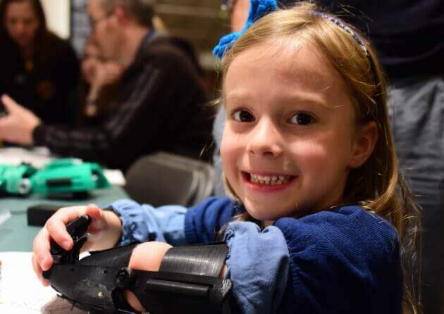 3d printed prosthetics