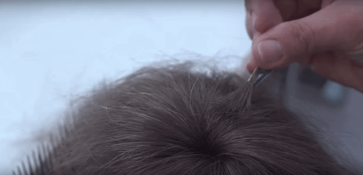 scalp