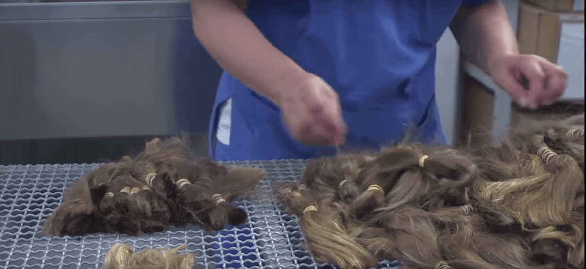 scalp