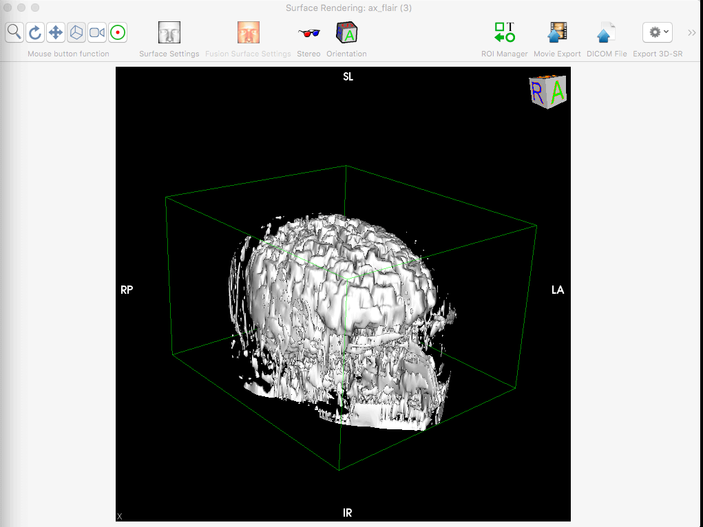 Just editing a brain...