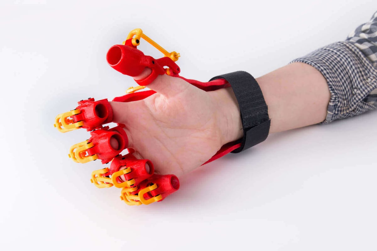 Rehabilitation Orthosis