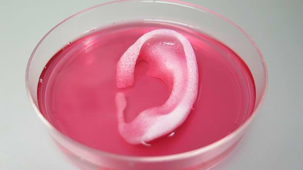 3d printed ear