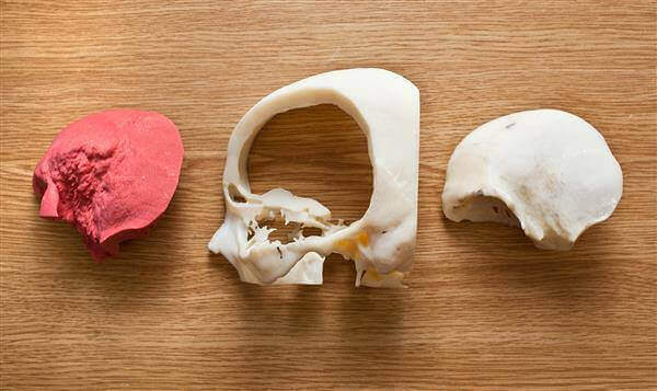 uk-murder-trial-prosecutor-presents-3d-printed-replica-skulls-jury-makes-legal-history-1