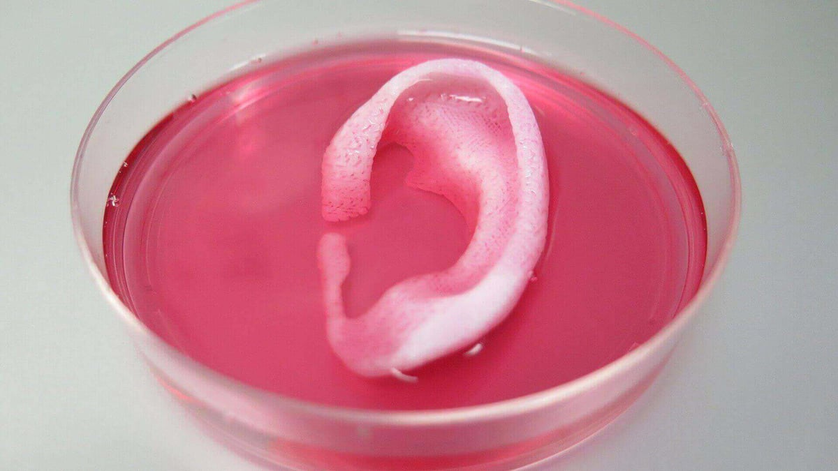 101 questions answered ear