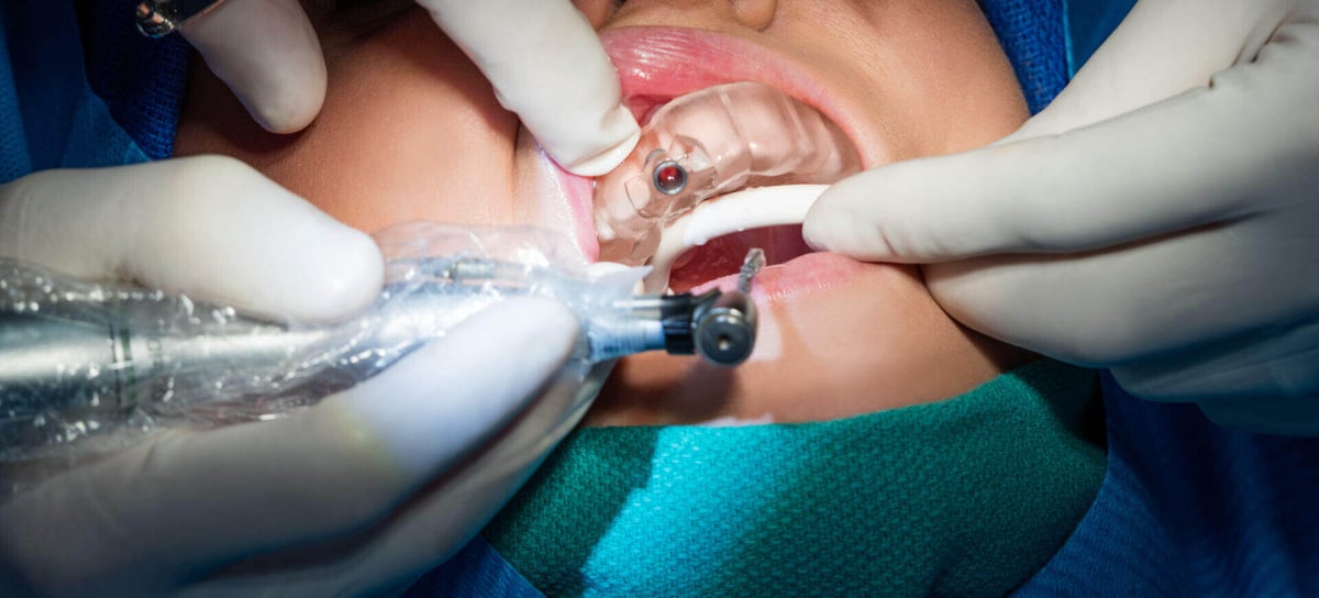 Formlabs 3Shape dental 3d printing