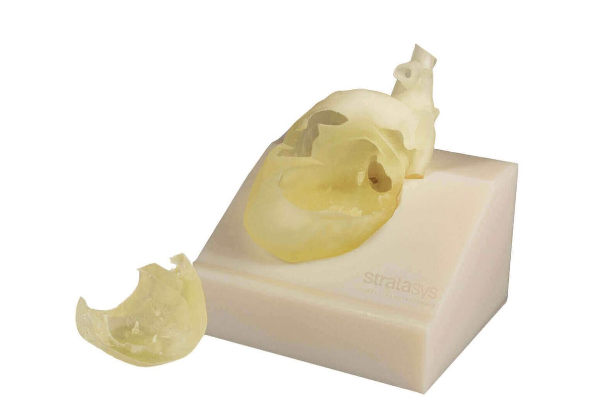 3d printing heart surgery