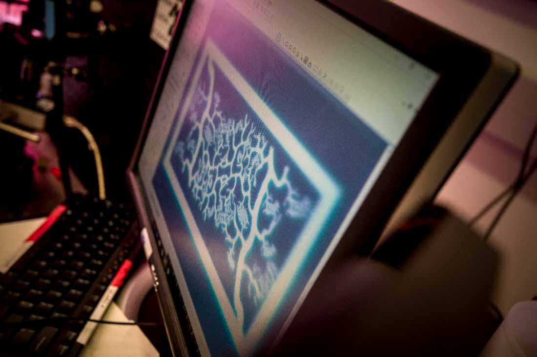 3D printed blood vessels