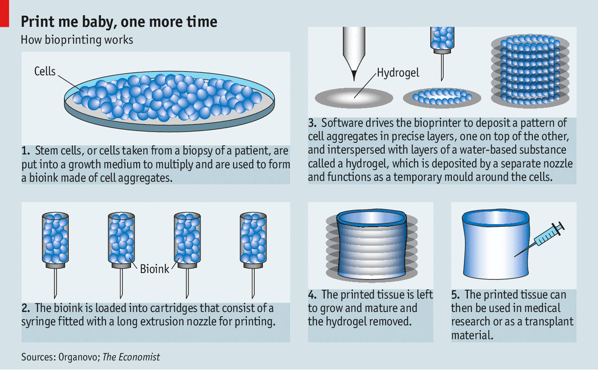 artificial pancreas