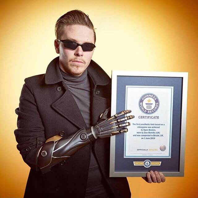 Open Bionics