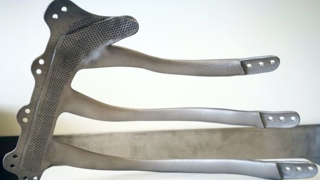 3D Printed Implant