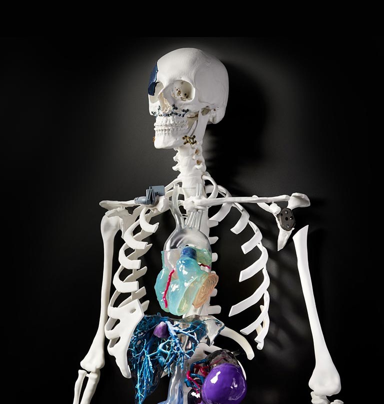 3d printed anatomical models