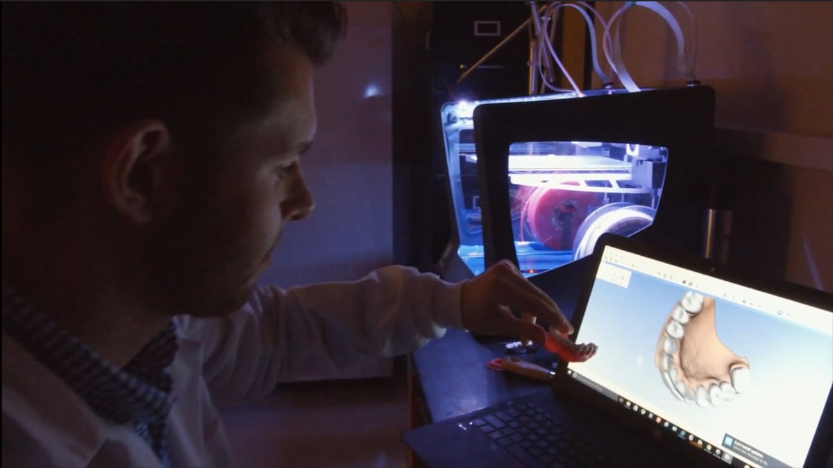 3d printed dentures