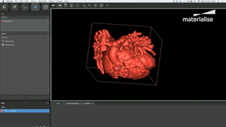 Materialise
