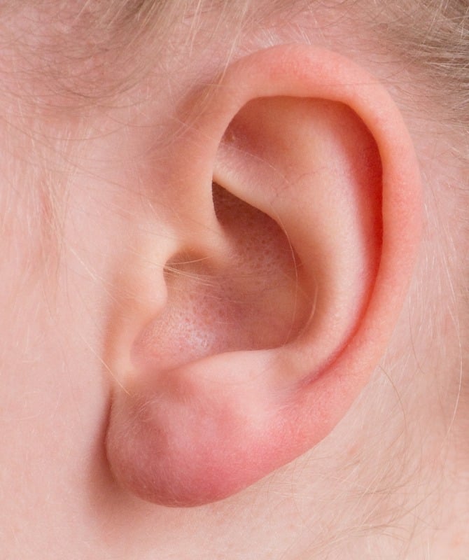 3D printed human ears