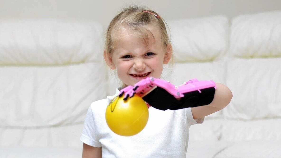Featured image of E-Nabling Everyone to Give a 3D Printed Hand