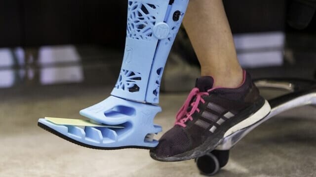 Featured image of This is the First 3D Printed Prosthetic Leg in the UAE