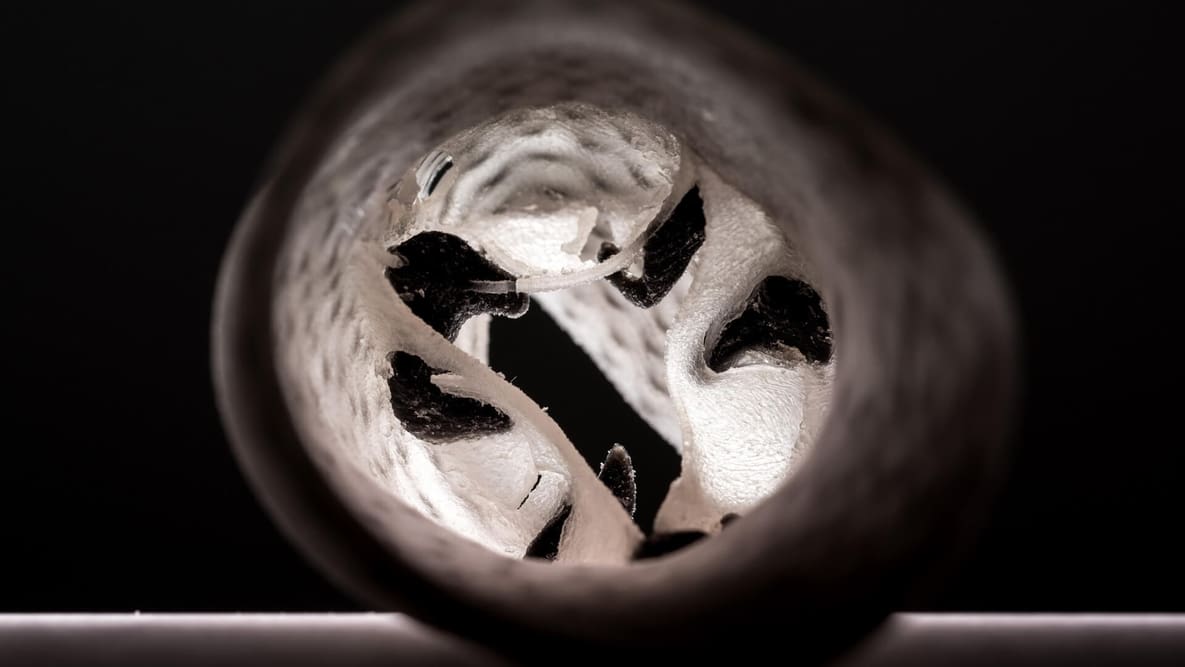 Featured image of 3D Printed Heart Valves Improve Surgery Success Rates