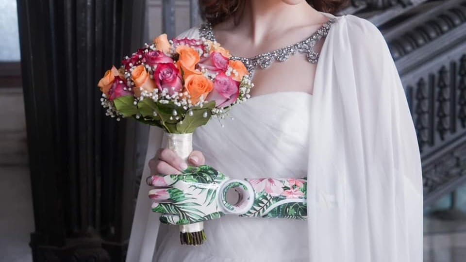 Featured image of This Company is Using 3D Printing to Create Beautiful, Custom Prosthetic Limbs