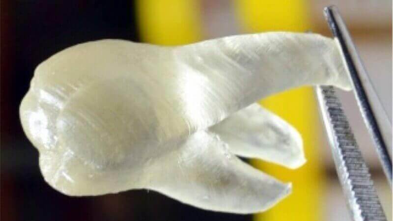 Featured image of 3D Printed Teeth Kill Mouth Bacteria on Contact