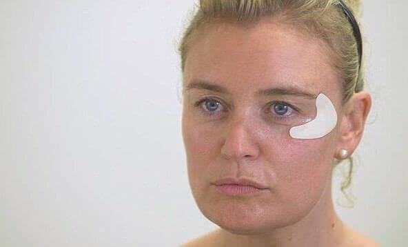 Featured image of 3D Printed Wrinkle Removal Stabs You With 2,000 Needles
