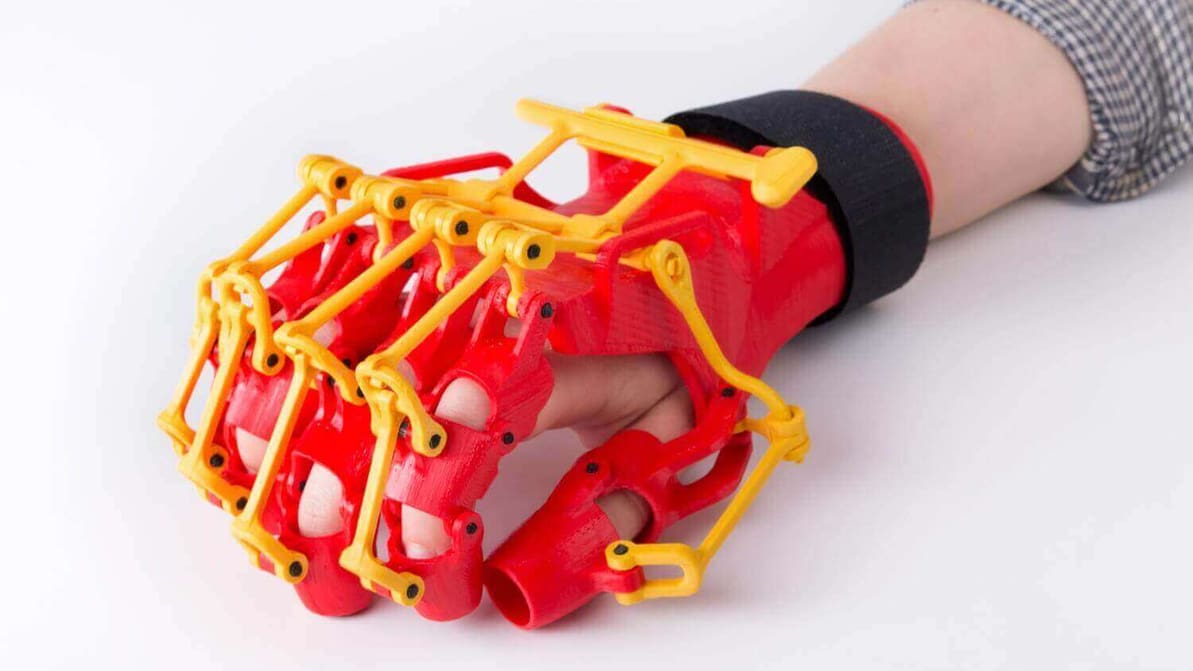 Featured image of 3D Printed Rehabilitation Orthosis by ZMorph