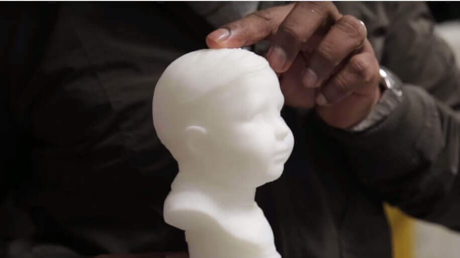 Featured image of Visually Impaired Woman “Sees” Face of Boyfriend as Baby