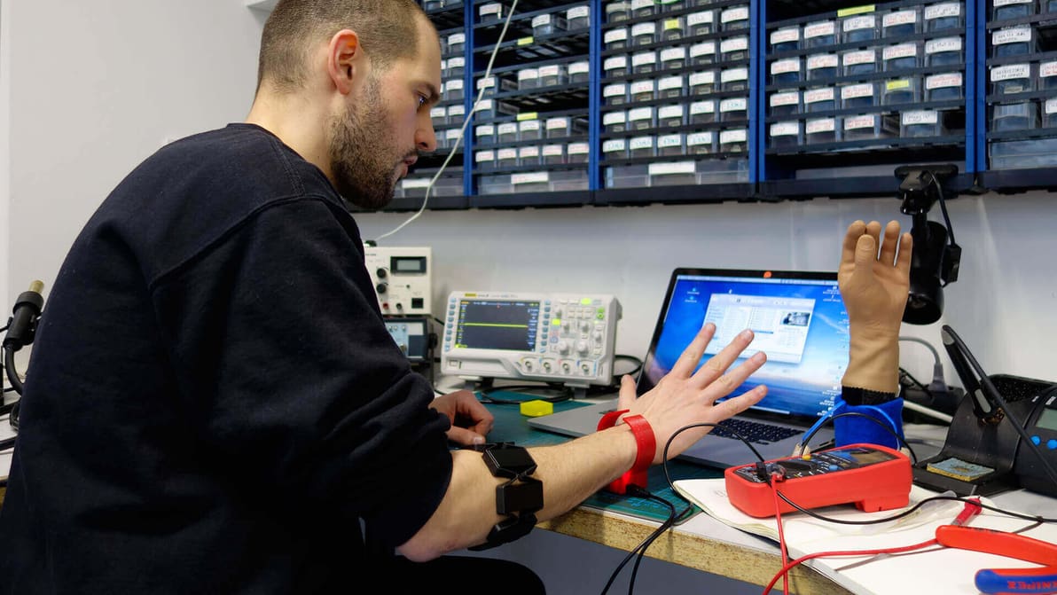 Featured image of 3D Printed Wristband turns Prosthetic Hand into a Mouse