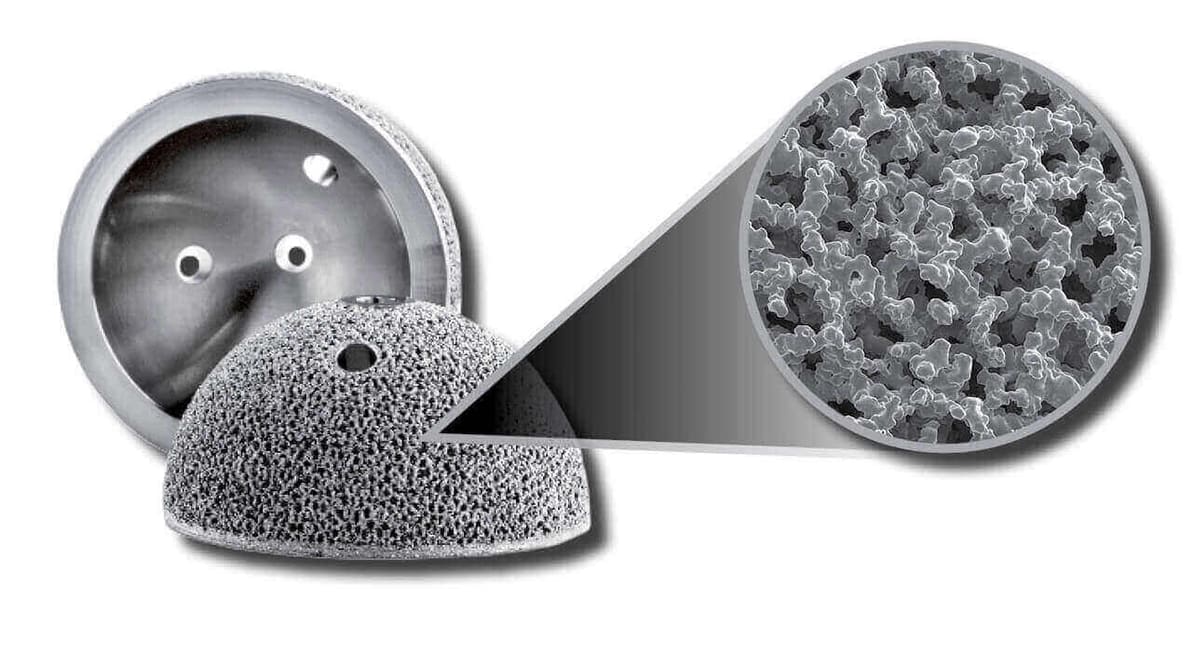 Featured image of Arcam Announces CoCr Process and New EBM Technology