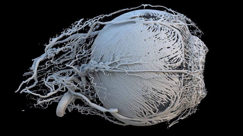 Featured image of 3D Printed Pig’s-Eye Model Shortlisted for Wellcome Image Awards 2017