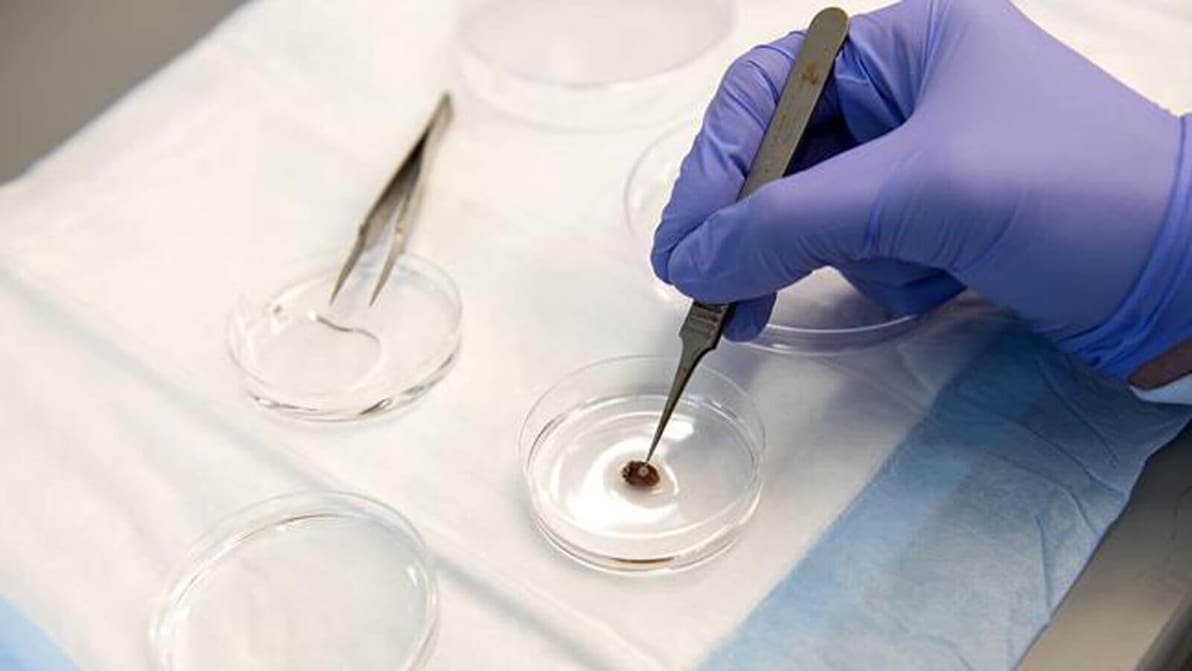 Featured image of 3D Printed Biopatch to Revolutionize Treatment for Heart Attacks