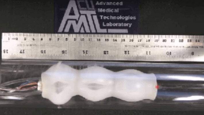 Featured image of Worm-Shaped Robot Removes Discomfort from Colonoscopies