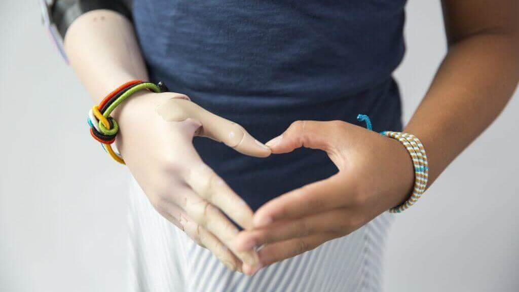 Featured image of Unlimited Tomorrow CEO Creates Lifelike 3D Printed Hand for Young Momo