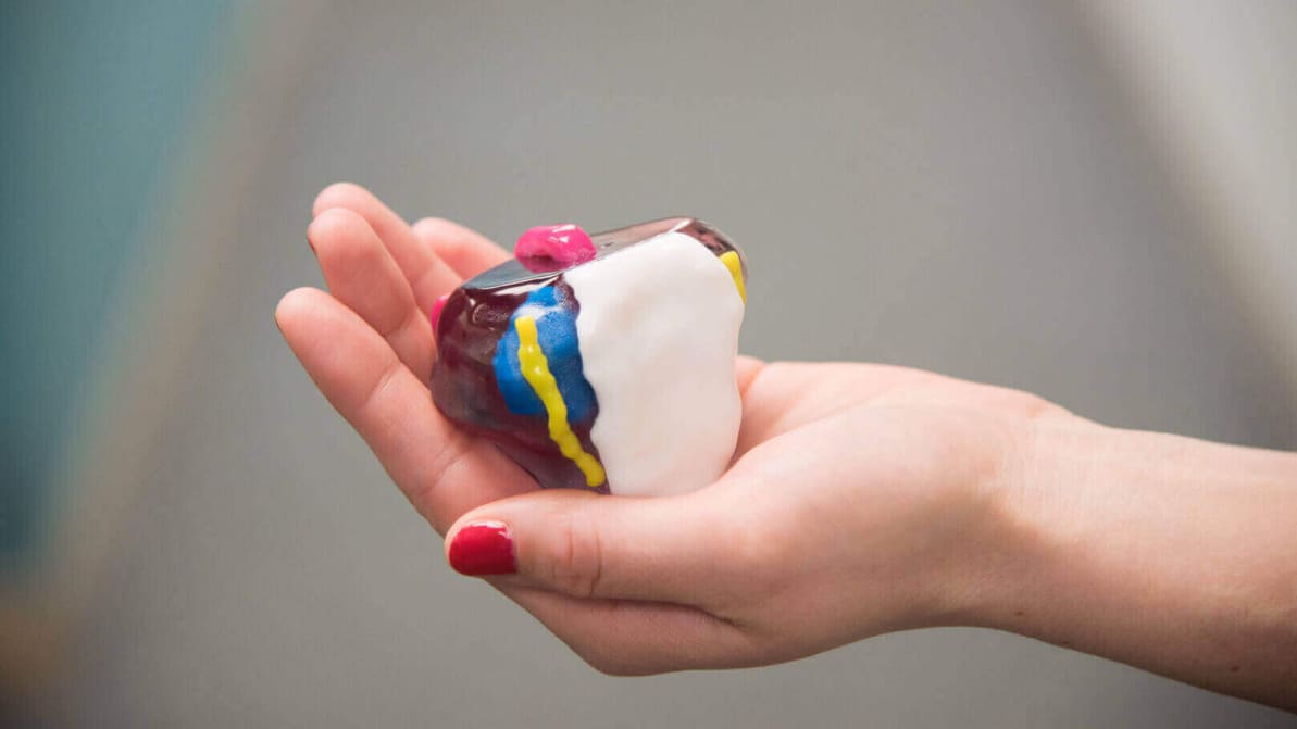 Featured image of 3D Printing Prostate Cancer Models for Surgical Planning