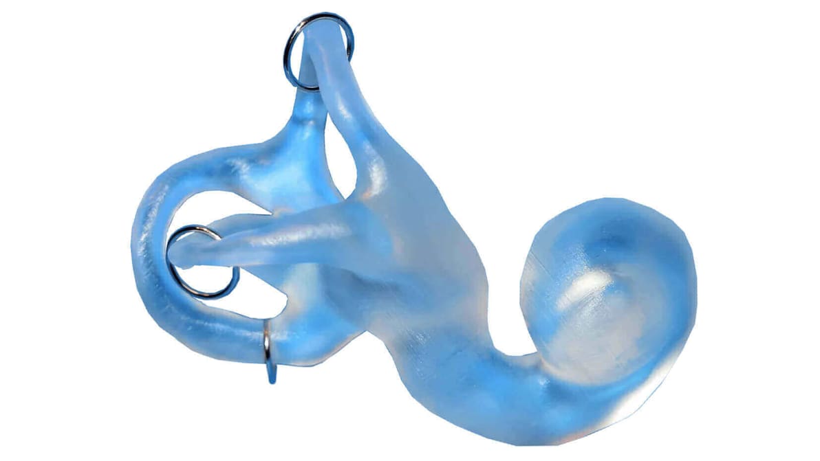 Featured image of How 3D Printing and Scanning Technologies Can Relieve Vertigo