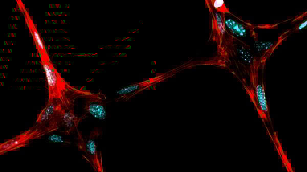 Featured image of Researchers Find New Low-Cost Ways to 3D Print Living Tissues and Organs