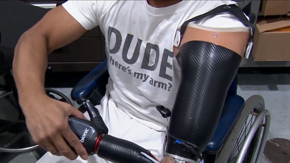Featured image of Honda Employees 3D Print Prosthetic Arm for Colleague