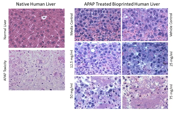 Featured image of Organovo Gets Orphan Drug Designation for 3D Printed Liver Tissue